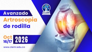 Avanzado Artroscopia De Rodilla